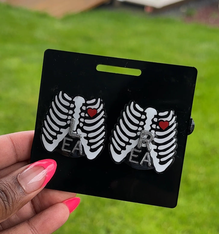 Rib cage xray markers